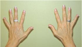 Hands_Open