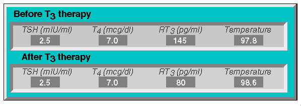 46RT3